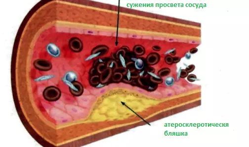 причина нарушения обмена веществ причина нарушения обмена веществ